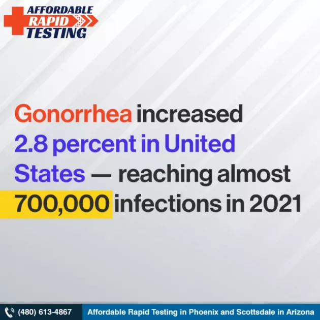 Affordable Rapid Testing Lab Chlamydia & gonorrhea std testing phoenix