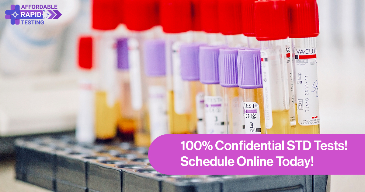 Affordable Rapid Testing Lab Get tested for std phoenix scottsdale