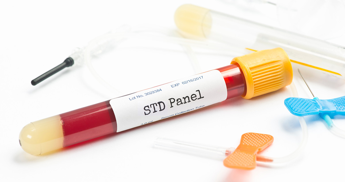 Affordable Rapid Testing Lab Affordable 100% confidential std testing & premium std panel testing